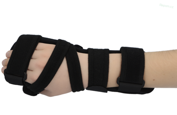 Ortéza zápěstí s podporou prstů UNI HAND